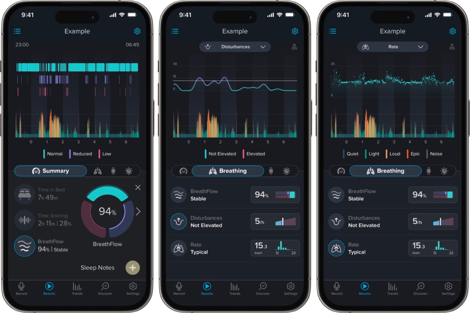 Jules Goldberg on the Future of Sleep Breathing Technology 7 The SnoreLab app interface displaying sleep breathing technology data